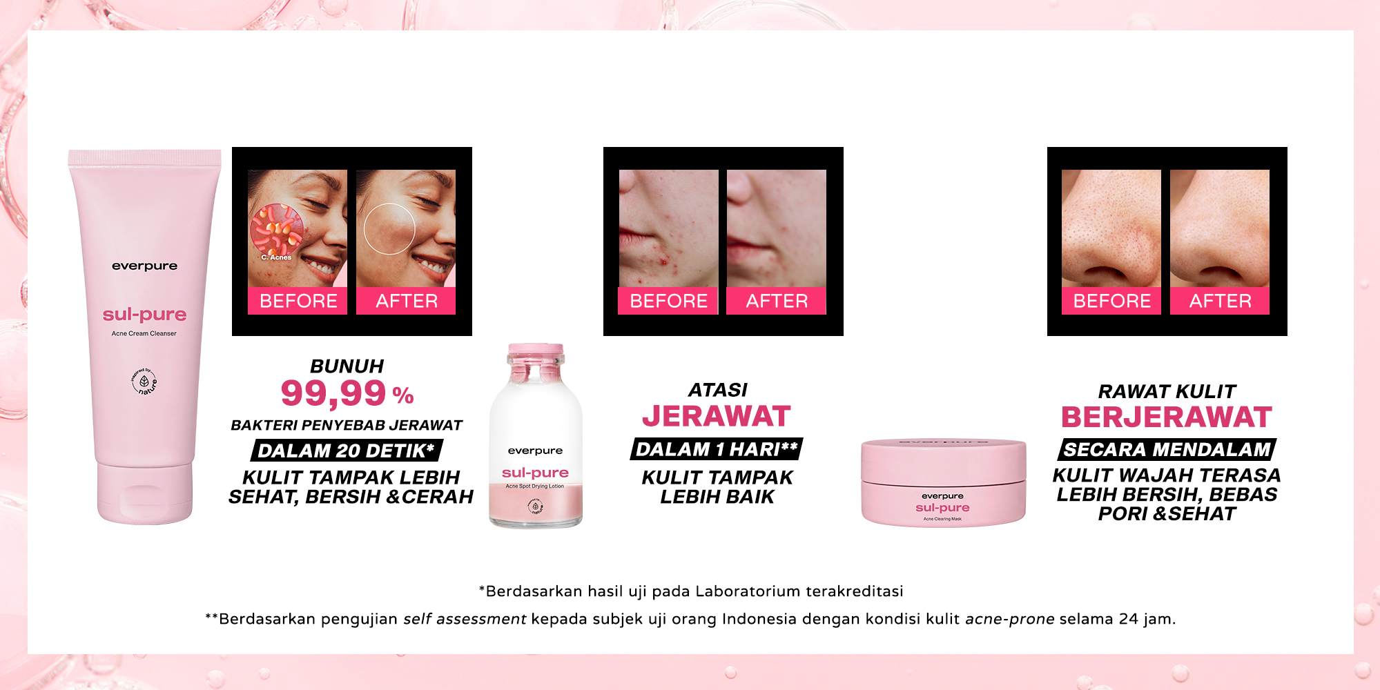 Toko Online Everpure Official Shop Shopee Indonesia